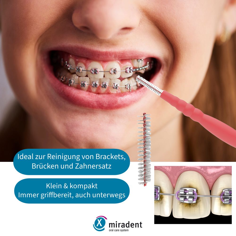 Personne avec un appareil dentaire utilise une brosse interdentaire rose. Gros plan sur les dents avec un appareil dentaire. Logo Miradent.