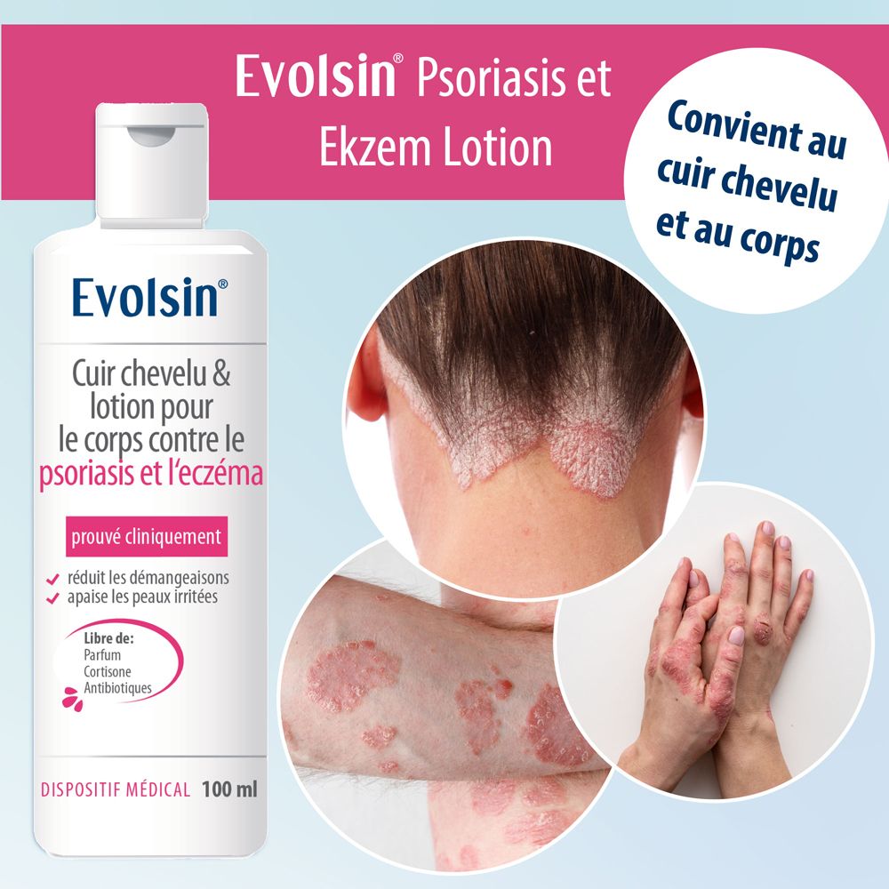 Evolsin Lotion Psoriasis et Ekzem. Pour cuir chevelu et corps. Cliniquement prouvé. 100ml.