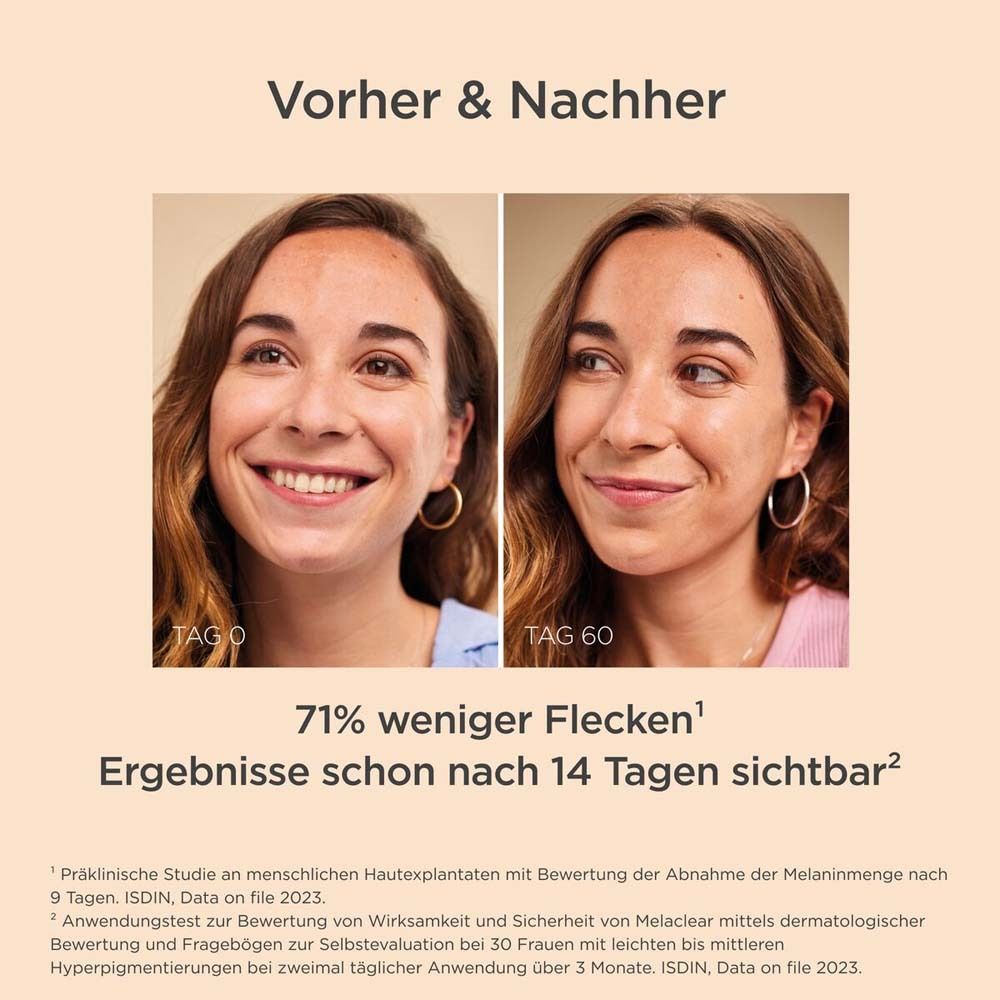 Comparaison avant-après. Deux femmes. Texte : 71% moins de taches. Résultats visibles après 14 jours.
