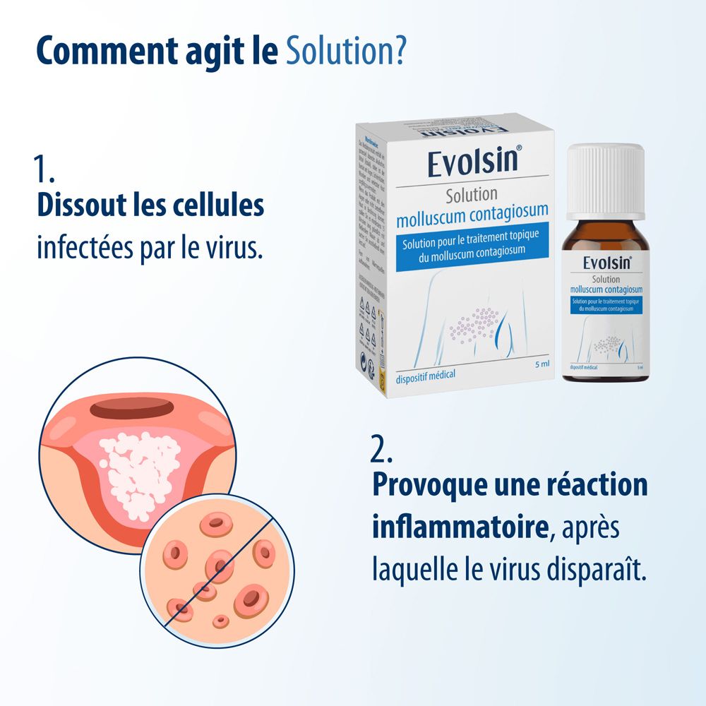 Mécanisme d'action d'Evolsin : dissout les cellules infectées, provoque une inflammation.