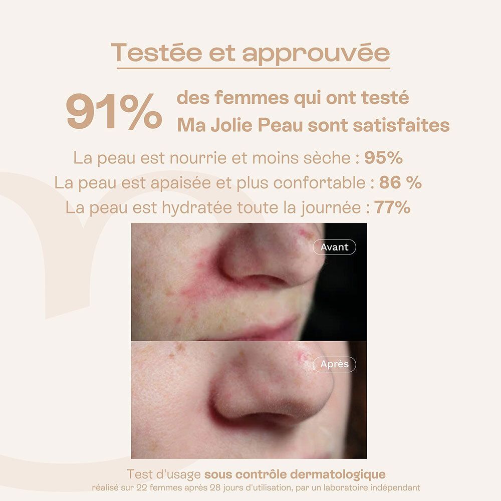 Comparaison avant/après de la peau après utilisation de la crème visage OMUM Ma Jolie Peau.
