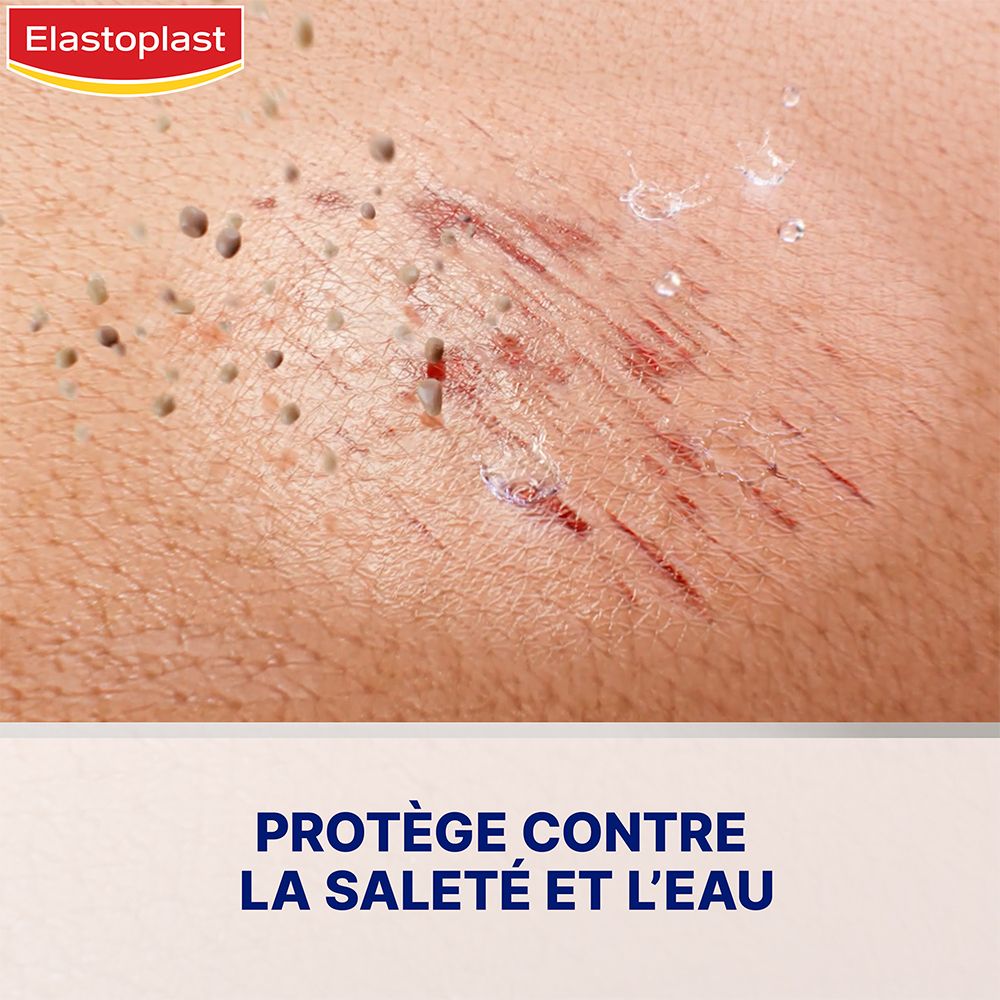 Gros plan sur une plaie cutanée. Pansement spray appliqué. Texte: Protège contre la saleté et l'eau.