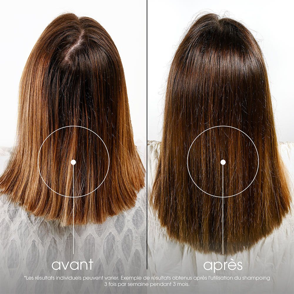 Comparaison avant-après des cheveux. Les deux vues montrent le cuir chevelu. Texte : Les résultats individuels peuvent varier.