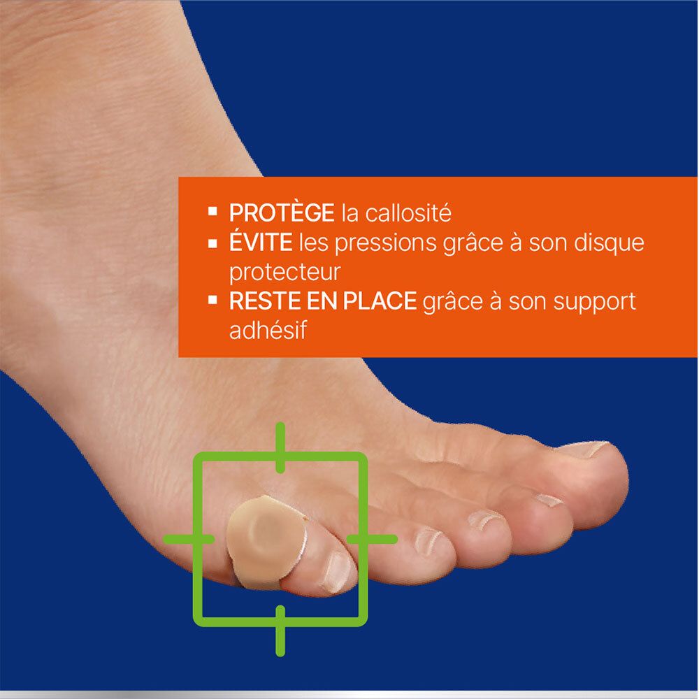 Gros plan d'un pied avec cor et pansement. Textes: 'Protège la callosité', 'Évite les pressions', 'Reste en place'.