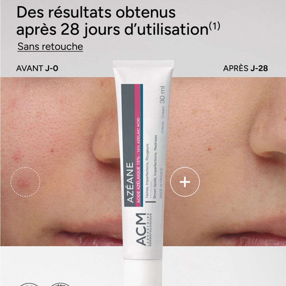 Comparaison avant-après de la peau avec la crème ACM Azeane, montrant les résultats après 28 jours.