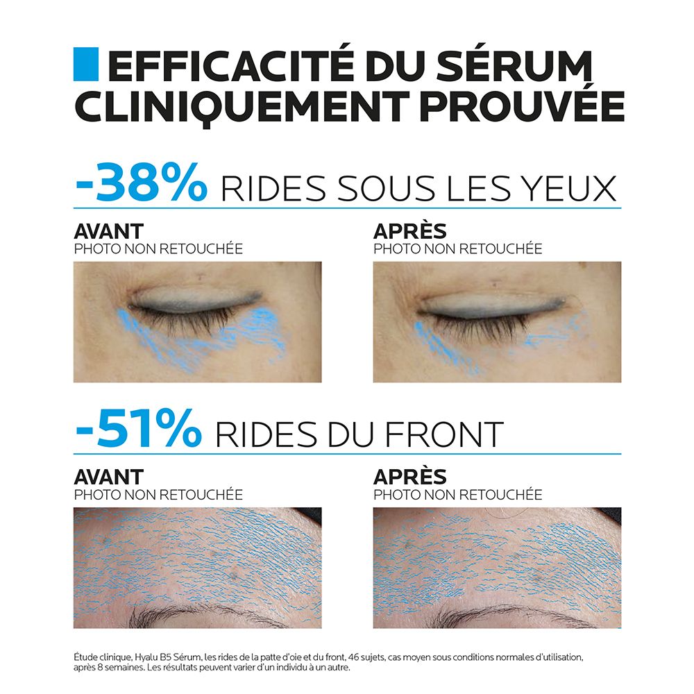 LA ROCHE-POSAY Hyalu B5 Sérum concentré anti-rides réparateur repulpant