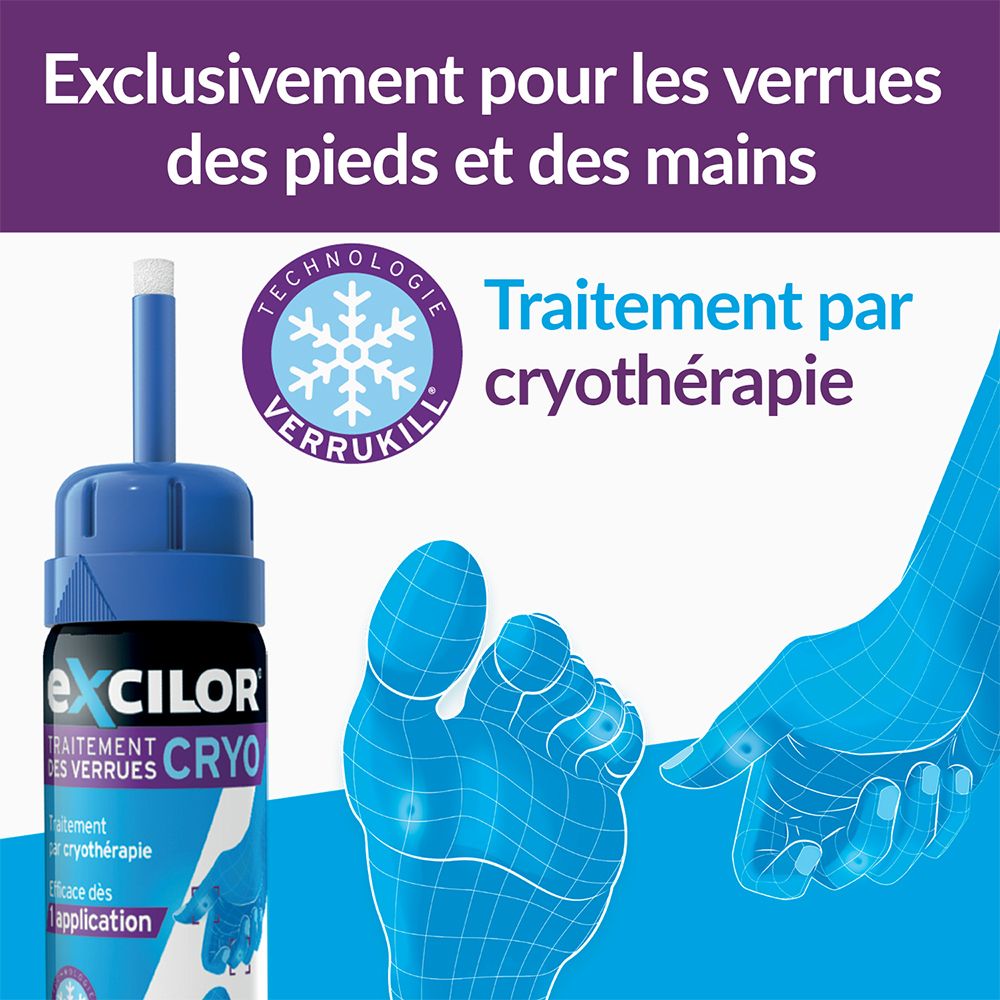 Excilor cryo verrue