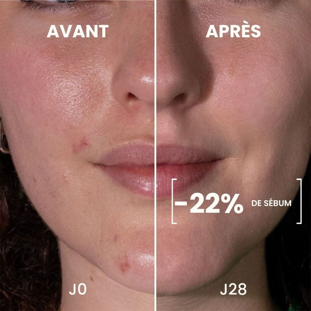 Visage avant et après application. Inscriptions: Avant, Après. Réduction de -22% de sébum. Amélioration de l'aspect de la peau.