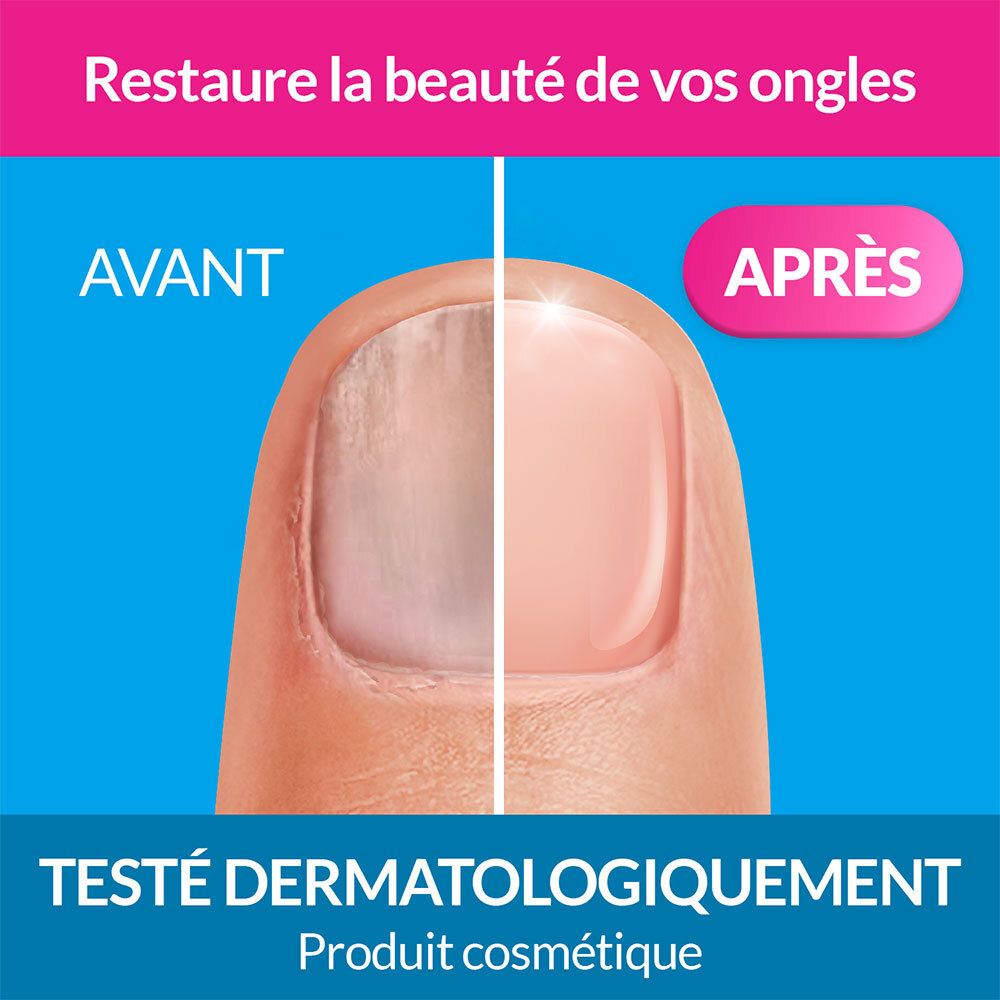 Comparaison avant/après d'un ongle. Texte : Restaure la beauté de vos ongles. Testé dermatologiquement.