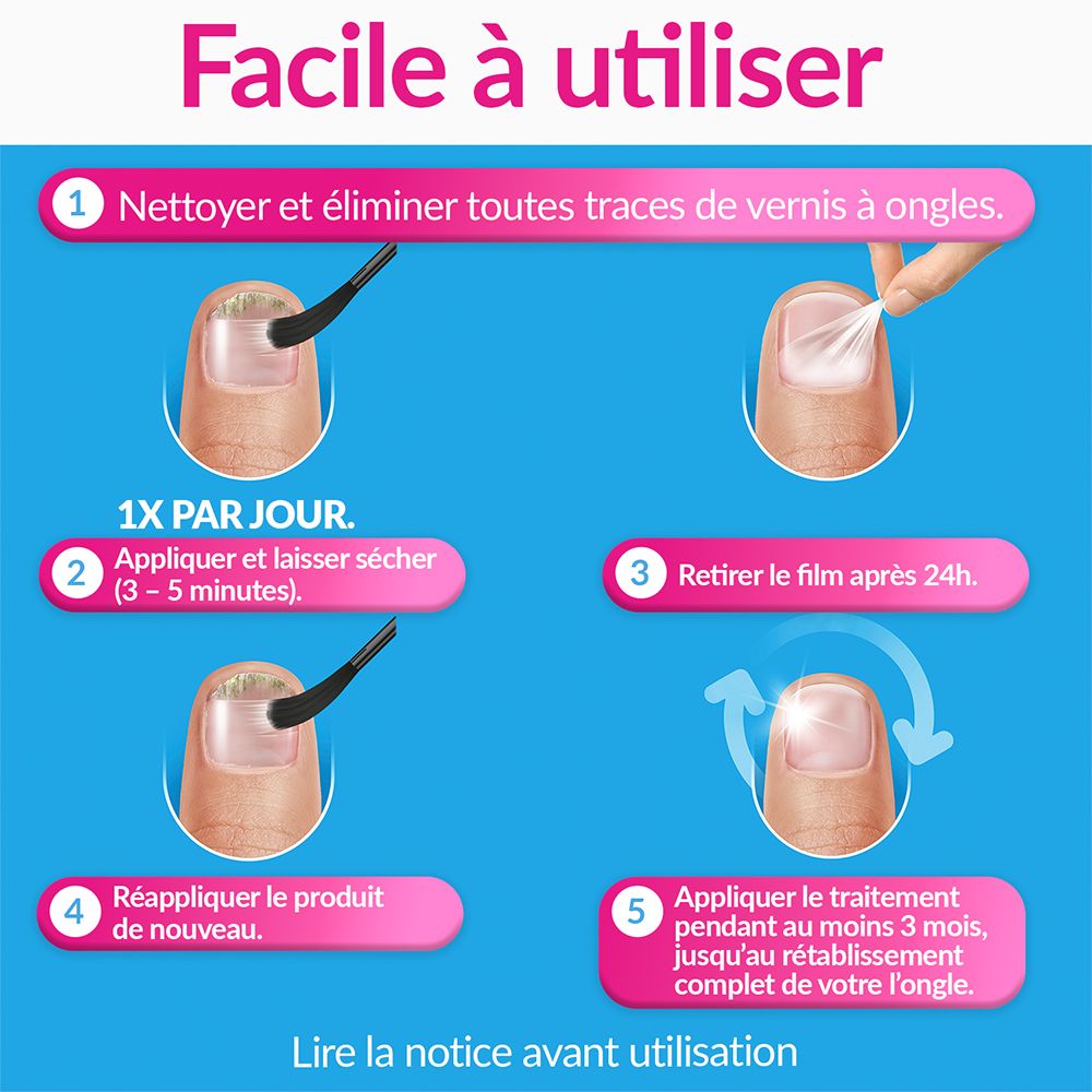 EXCILOR® FORTE Traitement de la mycose l'ongle