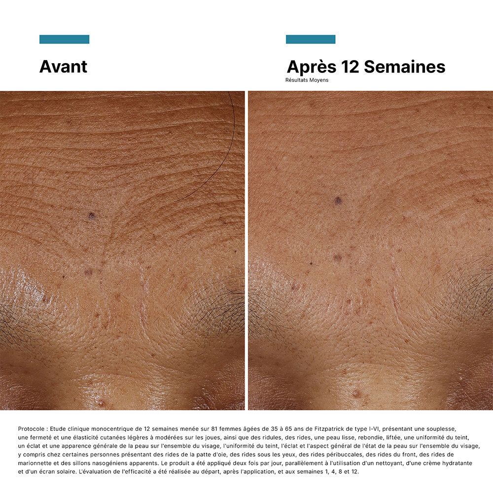 SkinCeuticals HA Intensifier Multi-Glycan