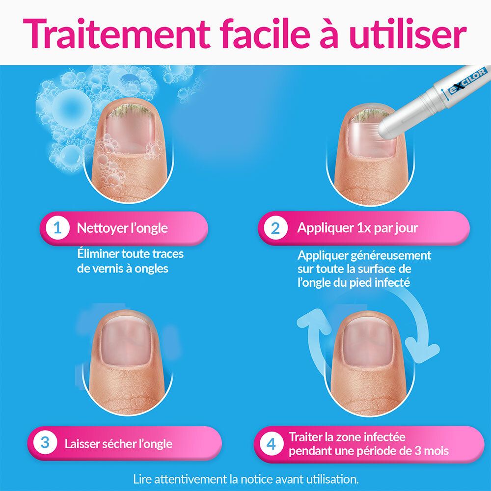 EXCILOR® - EASY - Traitement de la Mycose De l’Ongle - Déjaunissement actif - Pratique - Sans Limer - Séchage rapide - 1x/jour