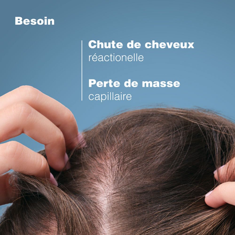Gros plan sur les cheveux et le cuir chevelu. Texte: Chute de cheveux réactionnelle, Perte de masse capillaire.