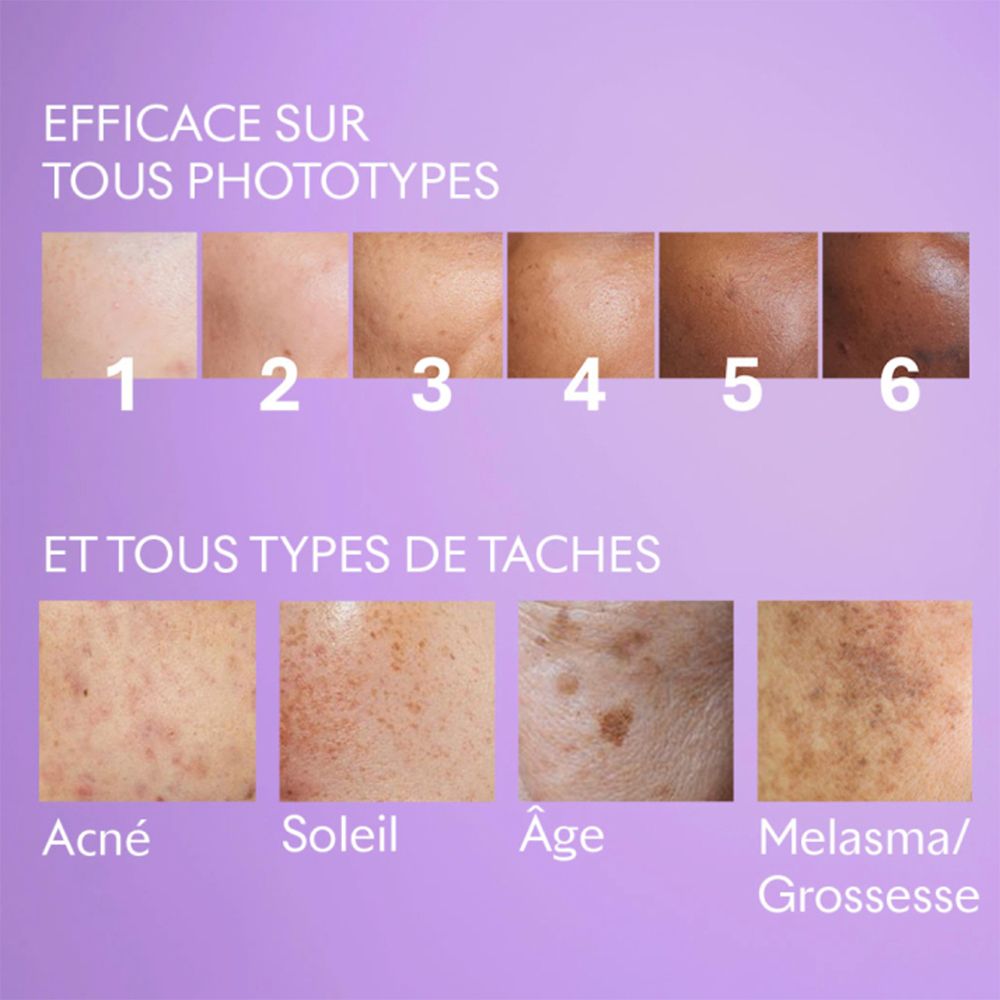 Tableau des phototypes de peau, de clair à foncé. En dessous: Acné, Soleil, Âge, Melasma/Grossesse.