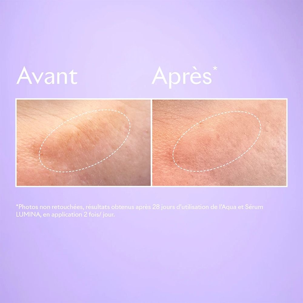 Image avant-après. Peau avec taches, puis peau améliorée.