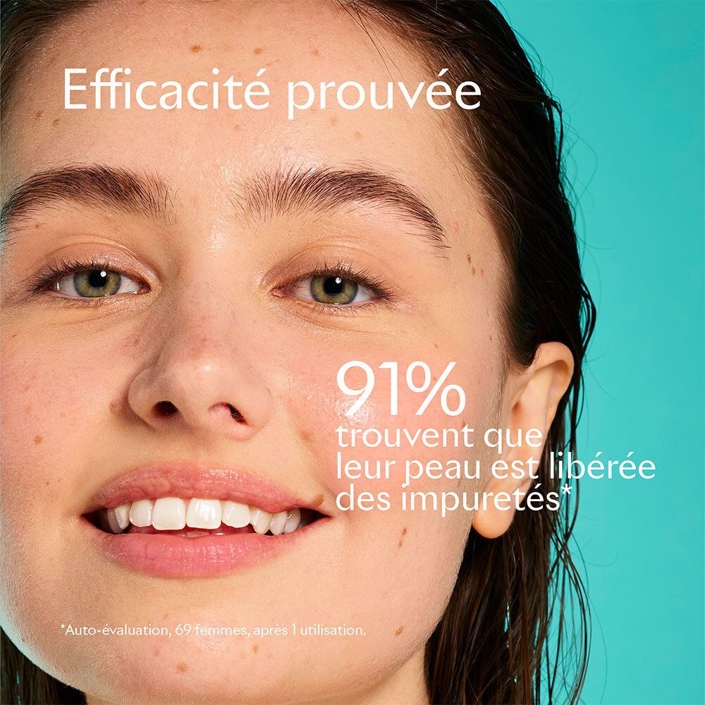 Portrait d'une femme avec imperfections cutanées. Texte : 91% trouvent que leur peau est libérée des impuretés.