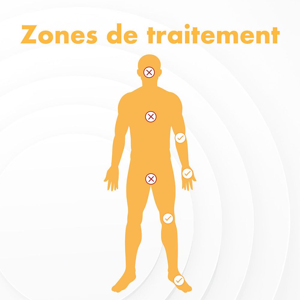 Schéma de traitement des verrues sur les mains, pieds et jambes. Pas pour le visage.