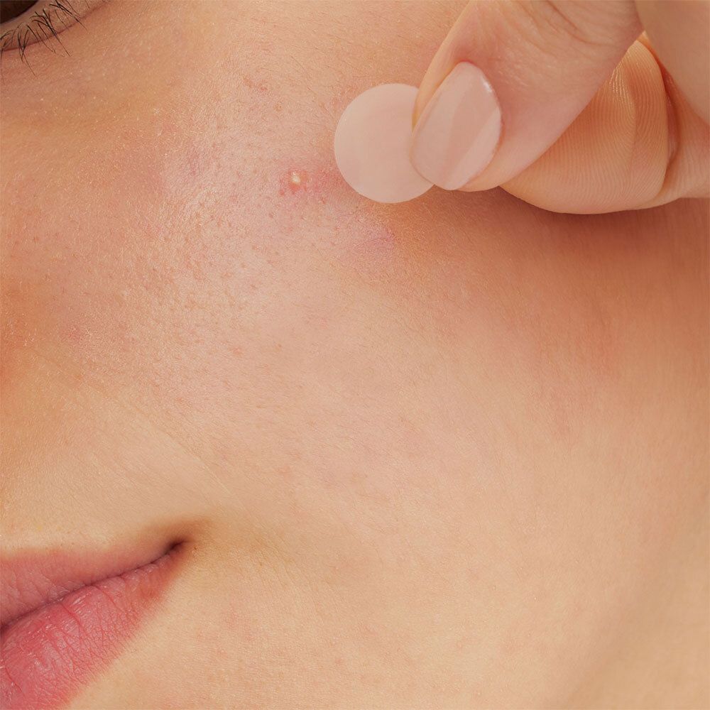 Gros plan sur un visage. Un patch est appliqué sur un bouton.