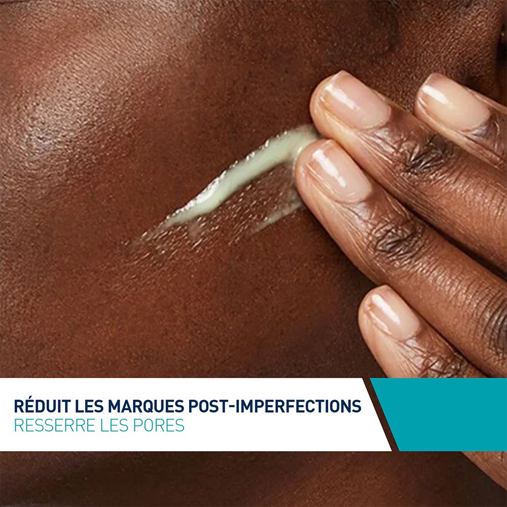 Application du sérum sur peau foncée. Réduit les marques post-imperfections et resserre les pores.