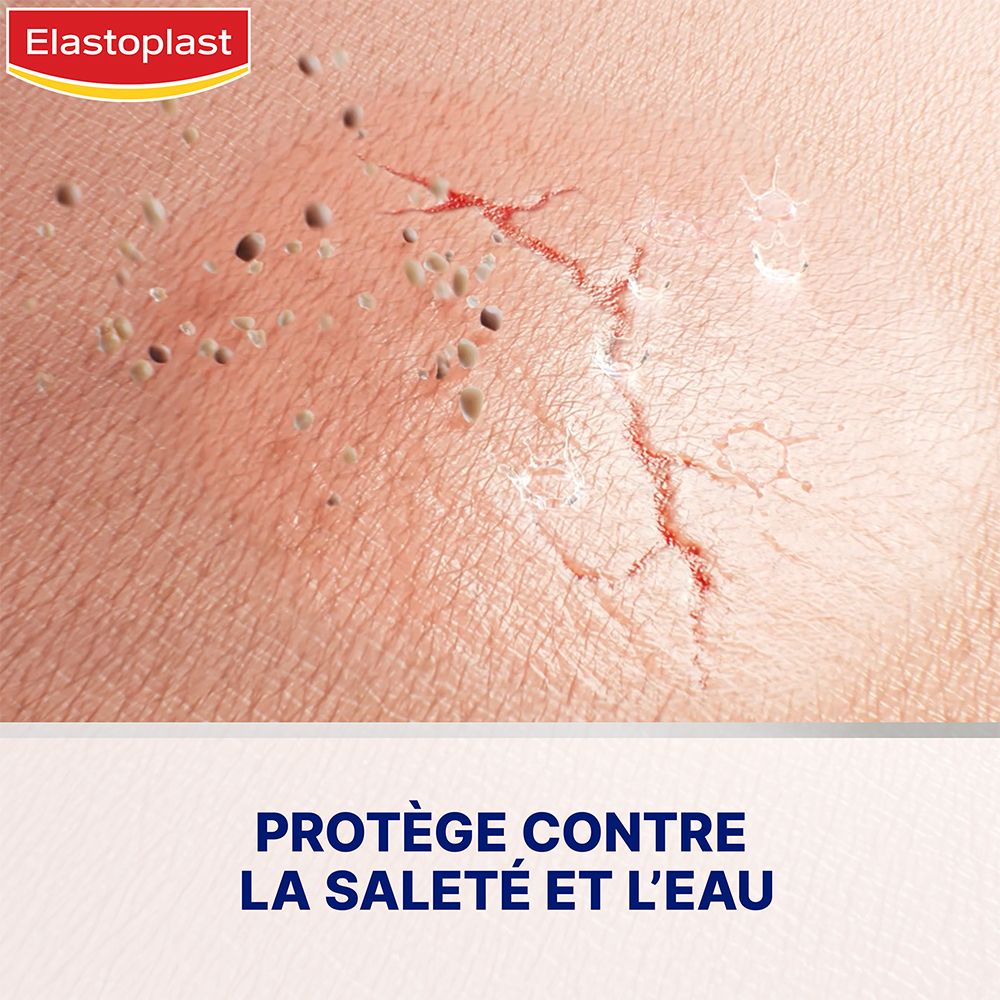 Peau avec fissures. Texte: Protège contre la saleté et l'eau. Elastoplast Pansement Liquide Concentré.