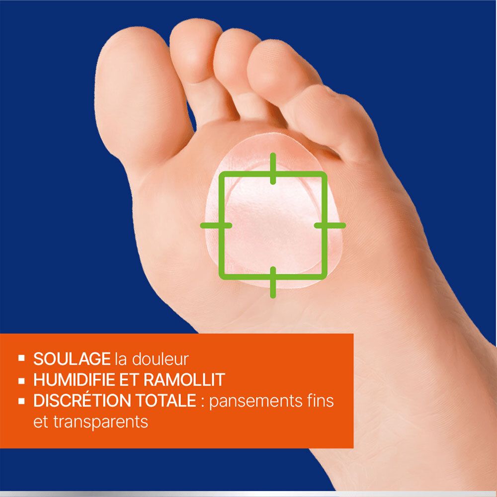 Gros plan d'un pied avec un pansement hydrocolloïde URGO Durillons sur un durillon.