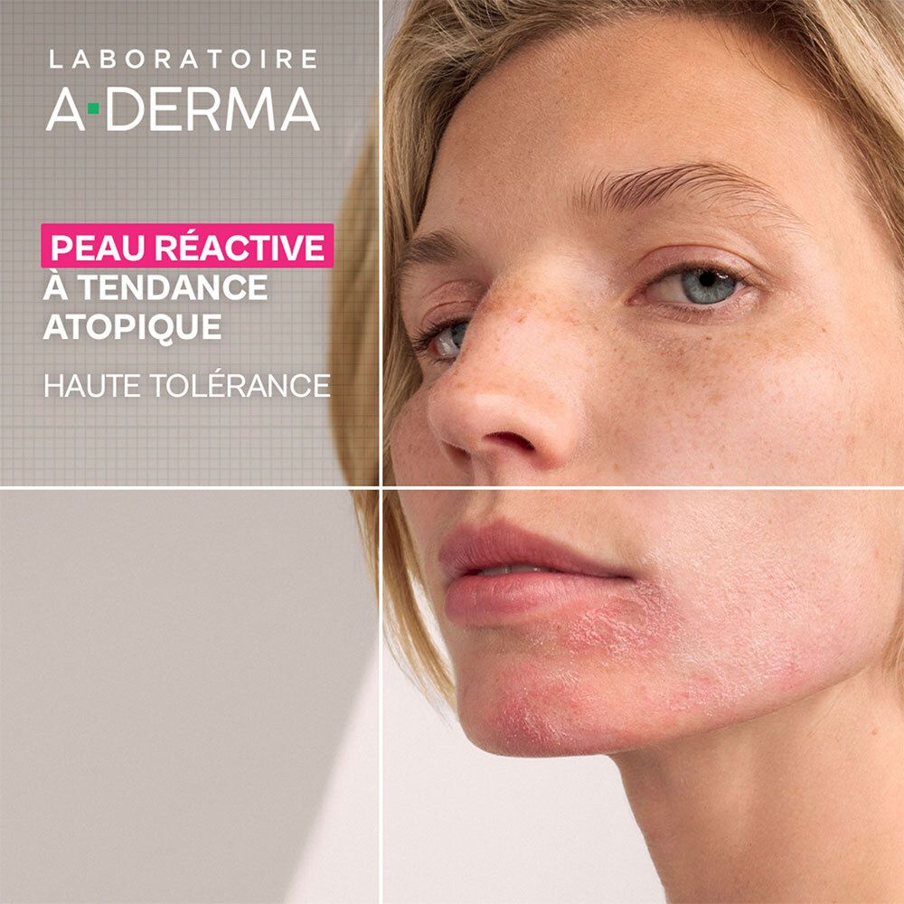 Femme à peau atopique utilisant le gel-crème apaisant A-Derma Exomega.