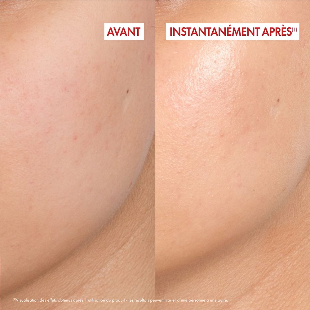 Comparaison avant-après de la peau. Texte : Immédiatement après. Amélioration de la peau.