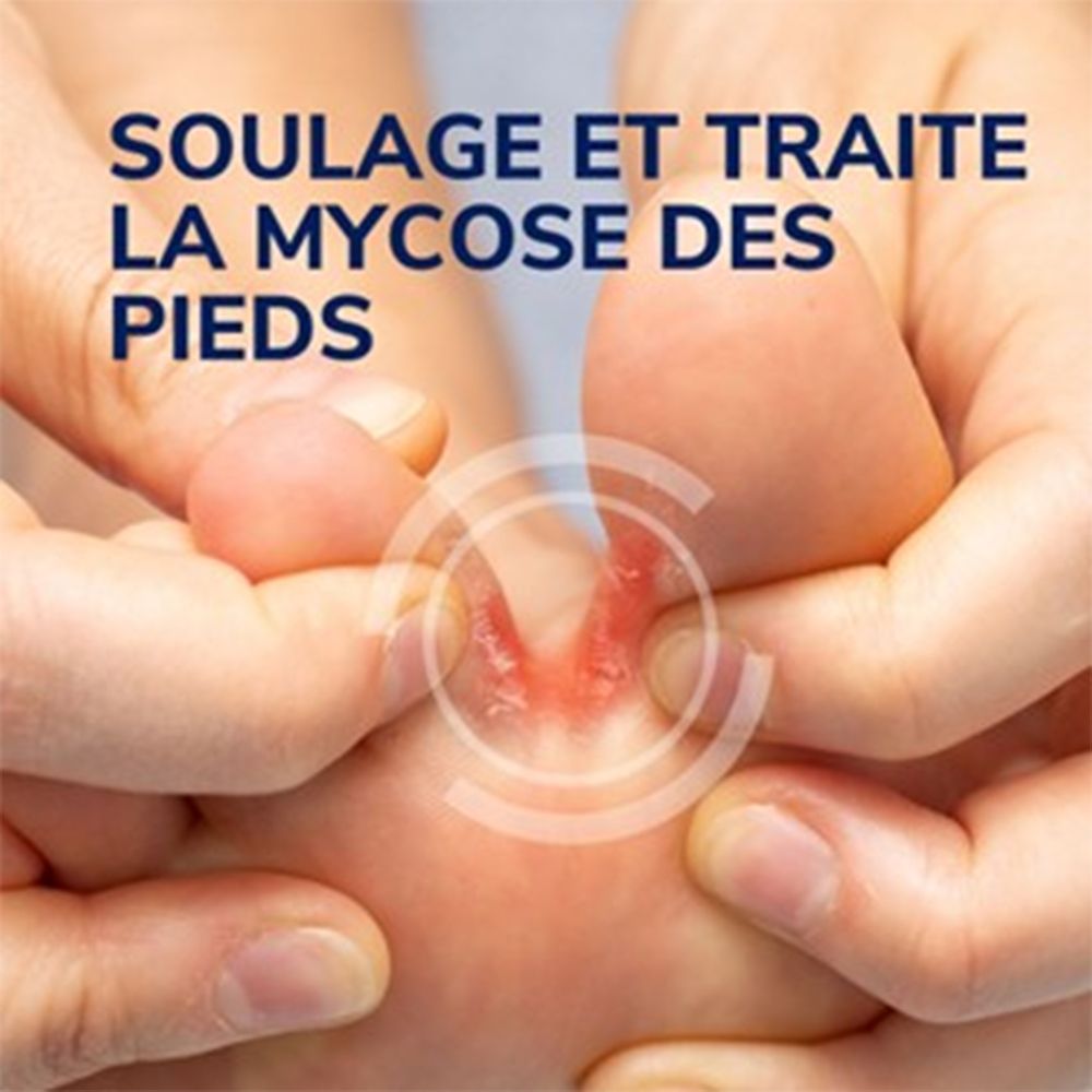 Dr. Scholl's Traitement Mycose des Pieds Gel 4-en-1 : Mains appliquant le gel sur une zone infectée entre les orteils.