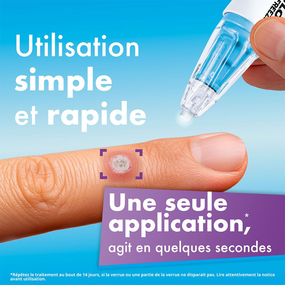 Applicateur Excilor ZéroVerrue Freeze appliqué sur une verrue au doigt.