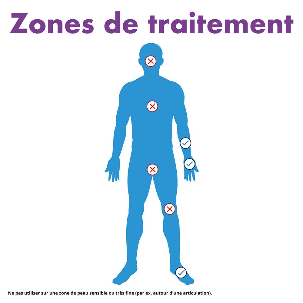 Schéma montrant les zones du corps traitables avec Excilor ZéroVerrue Freeze.
