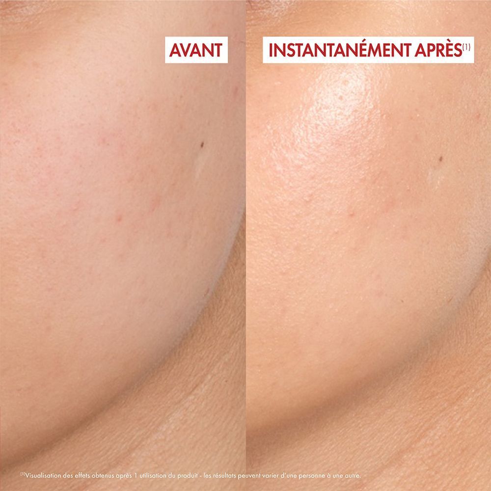 Comparaison de la peau avant et après utilisation. Texte: Avant et Instantanément Après.