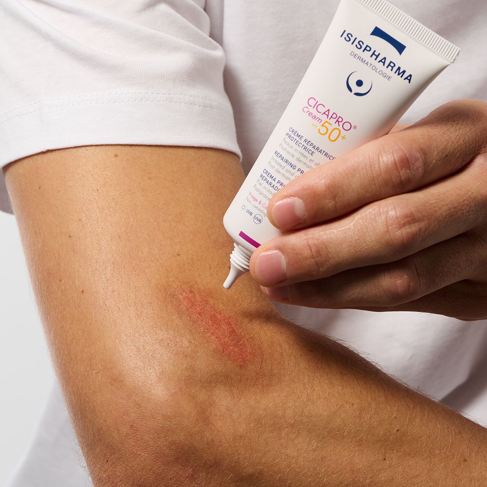 Un homme applique Isispharma Cicapro Cream SPF50+ sur une peau irritée du bras. Gros plan.