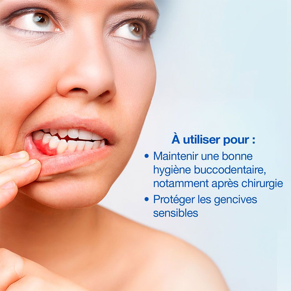 Femme avec gencives enflammées. HYALUGEL Forte Perio Spray pour maintenir l'hygiène buccodentaire, notamment après chirurgie.
