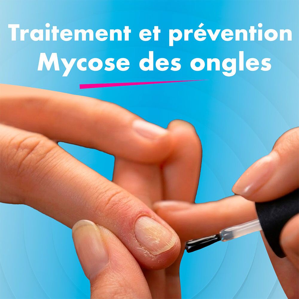 Application du traitement EXCILOR mycose de l'ongle sur un ongle infecté.