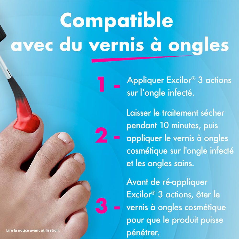 Le traitement EXCILOR mycose de l'ongle est compatible avec le vernis.