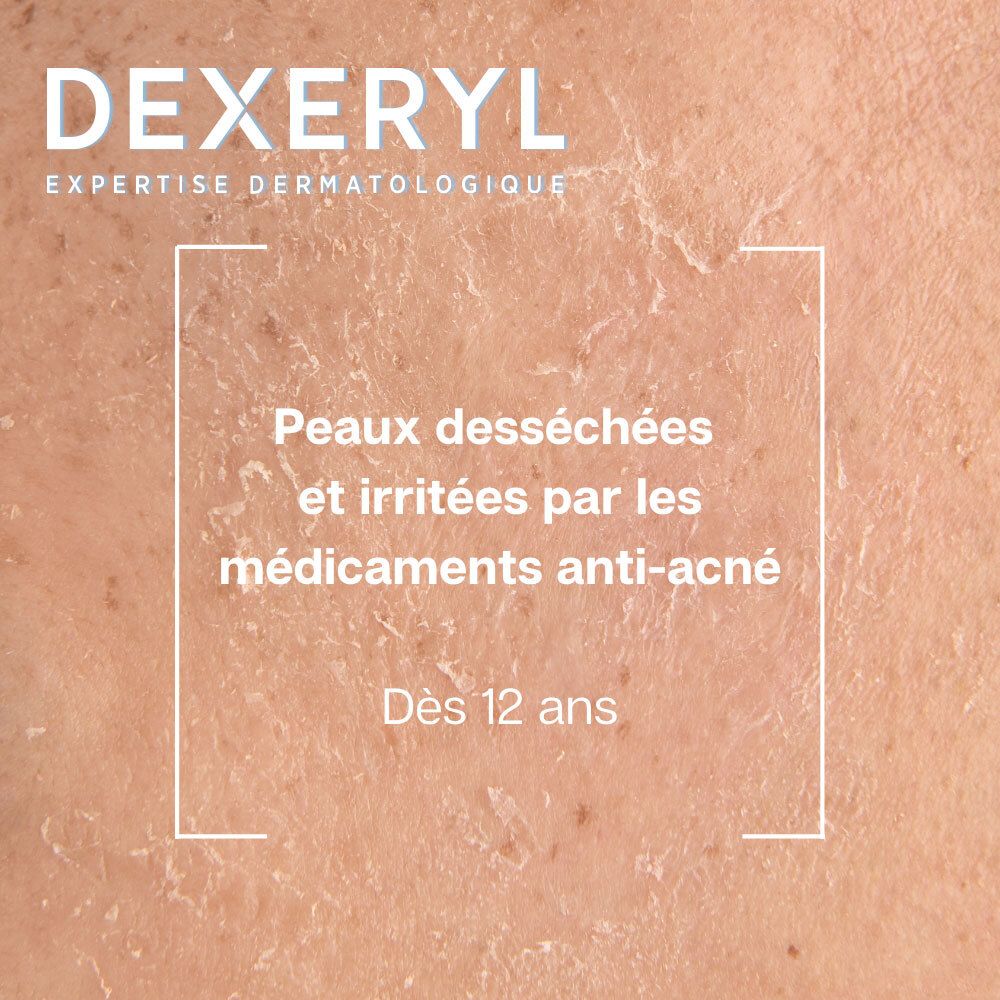 Peaux sèches et irritées par traitements anti-acné, dès 12 ans.