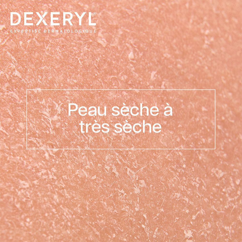 Gros plan sur peau sèche et squameuse.
