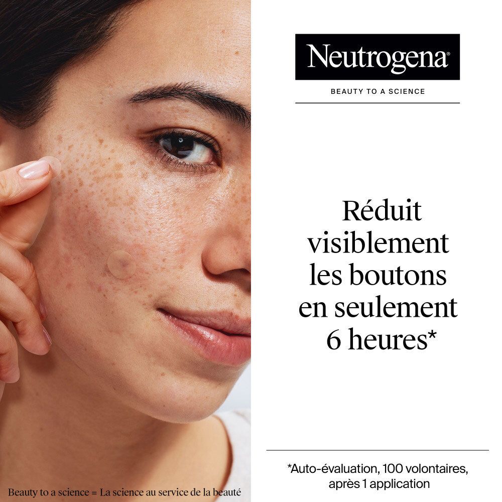 Visage de femme avec taches de rousseur, montrant l'efficacité des patchs Neutrogena Anti-Boutons en 6h.