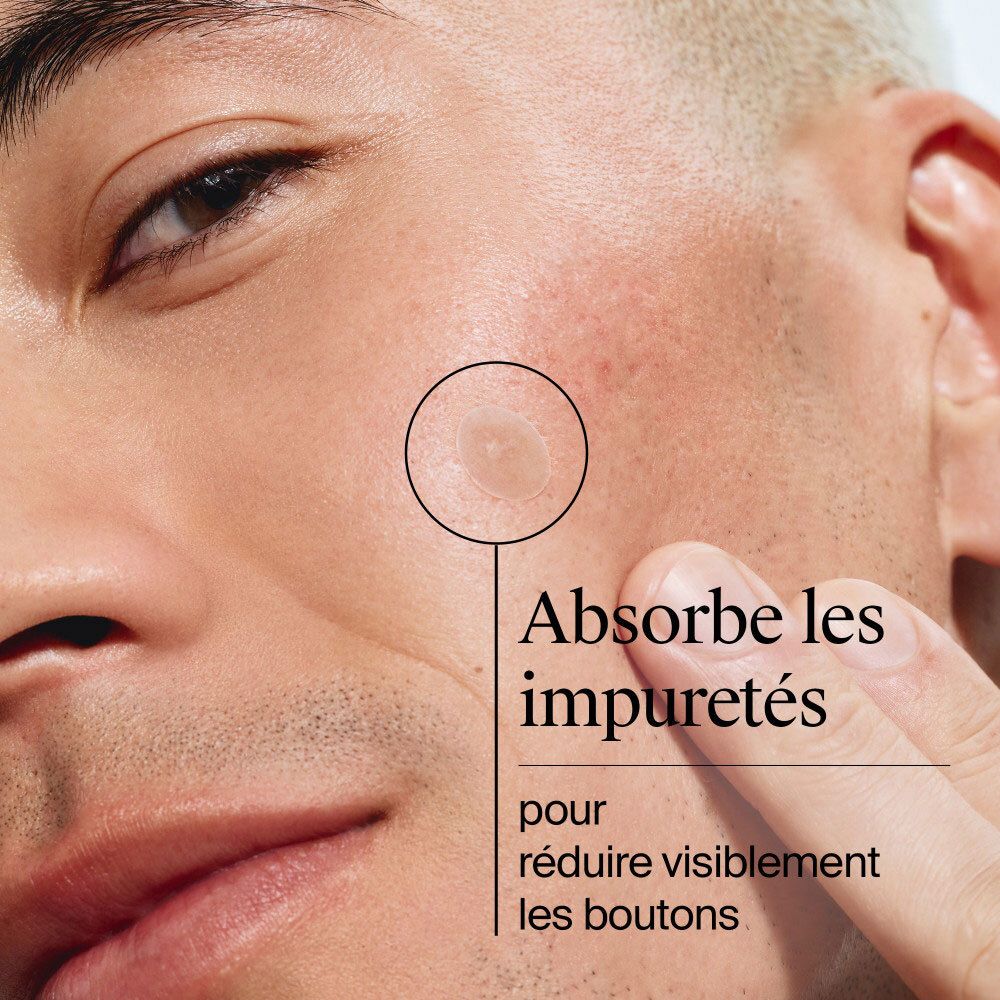 Gros plan sur un homme montrant un bouton avec un patch Neutrogena Anti-Boutons absorbant les impuretés.