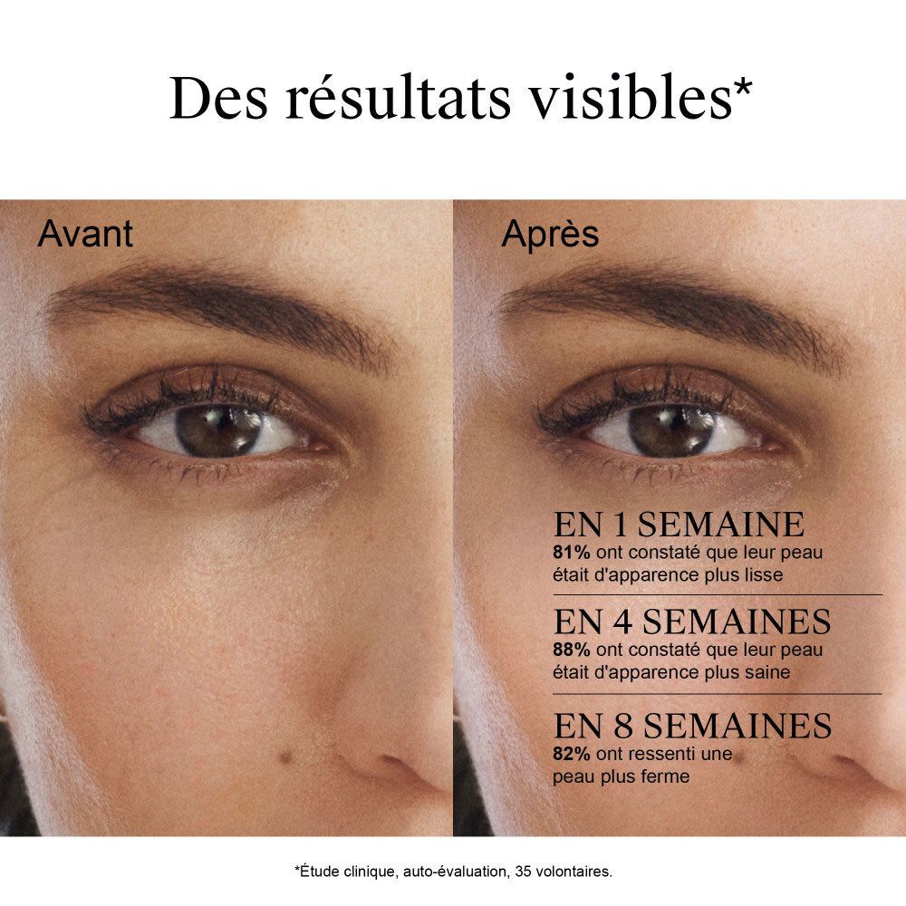 Images avant-après : apparence de la peau après 1, 4 et 8 semaines avec Neutrogena Retinol Boost+.