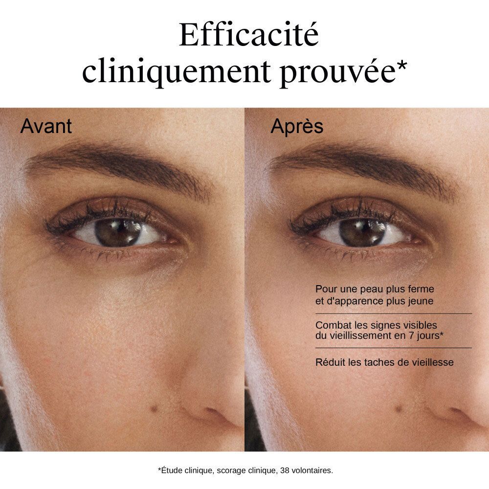 Images avant/après du contour des yeux montrant l'efficacité clinique de la crème.