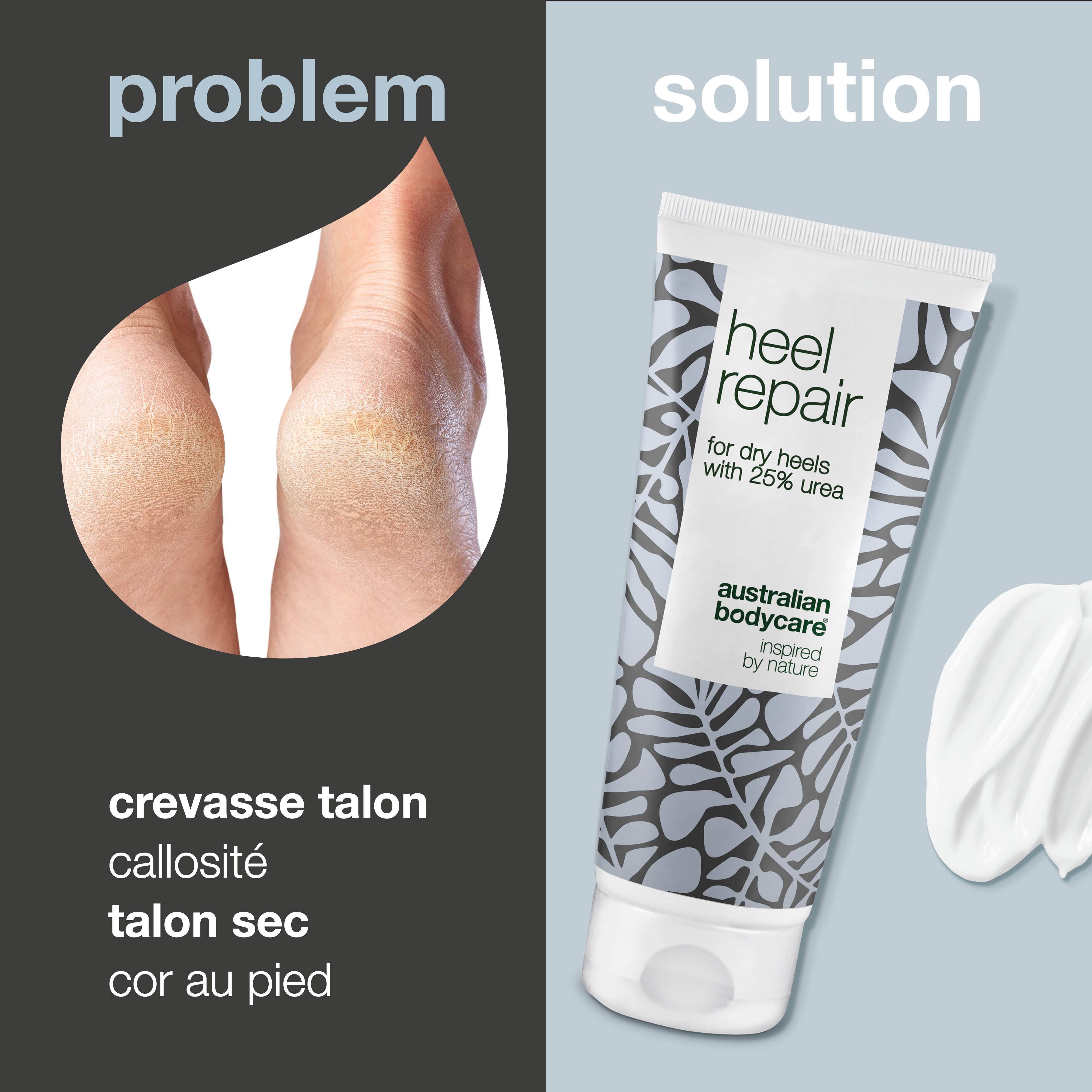 Comparaison de talons fendillés et tube de crème. Texte : Crevasse talon, callosité, talon sec, cor au pied. Marque : Australian Bodycare.