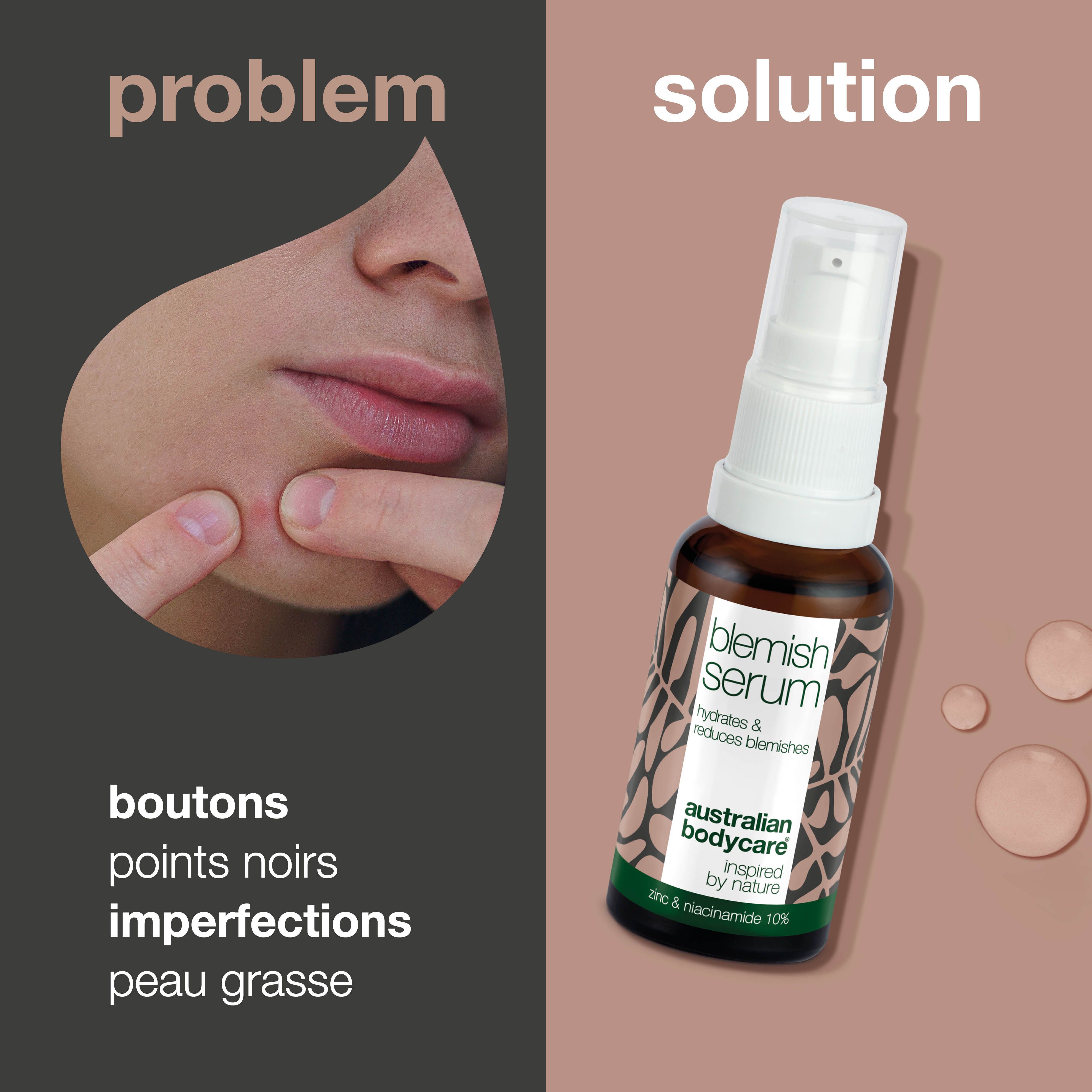 Image avec problème et solution. Flacon : Blemish Serum. Texte : boutons, points noirs, peau grasse.