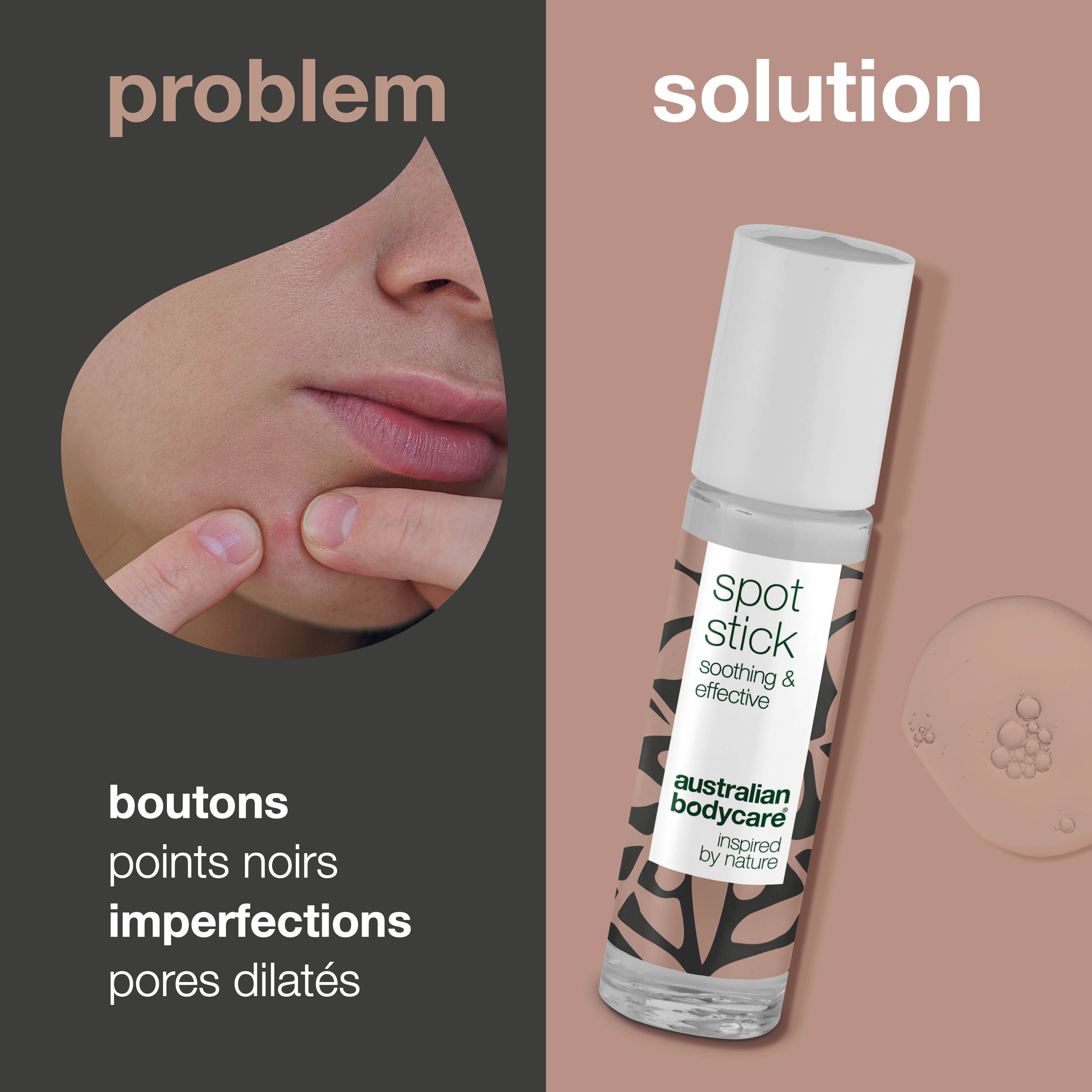 Spot Stick avec bouchon blanc. Inscription: Spot Stick, soothing & effective, Australian Bodycare.