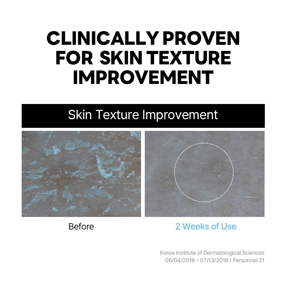Comparaison des textures de peau avant et après 2 semaines d'utilisation. Texte : Amélioration de la texture de la peau.